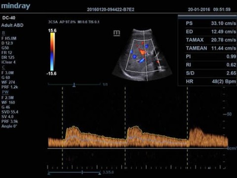 Аппарат ультразвуковой диагностический DC-40 - 397 700 руб.