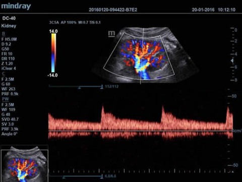 Аппарат ультразвуковой диагностический DC-40 - 397 700 руб.