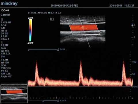 Аппарат ультразвуковой диагностический DC-40 - 397 700 руб.