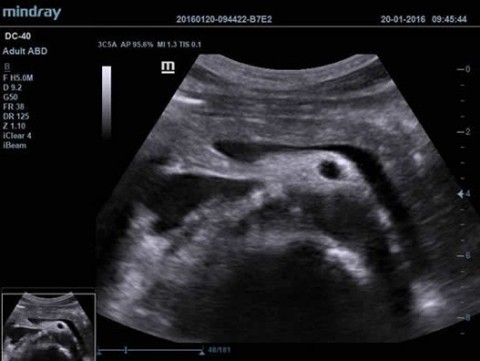 Аппарат ультразвуковой диагностический DC-40 - 397 700 руб.