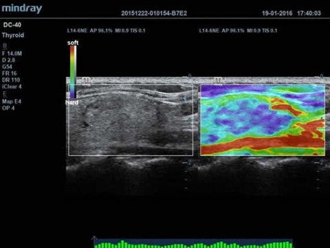 Аппарат ультразвуковой диагностический DC-40 - 397 700 руб.