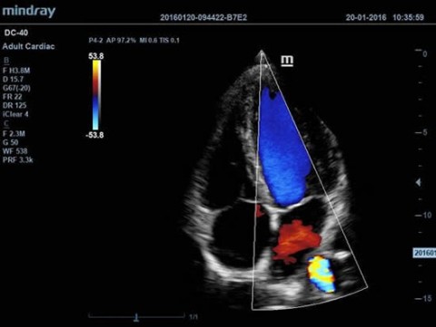 Аппарат ультразвуковой диагностический DC-40 - 397 700 руб.