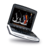 УЗИ аппарат Chison SonoTouch 80 (SonoBook 8) - 0 руб.
