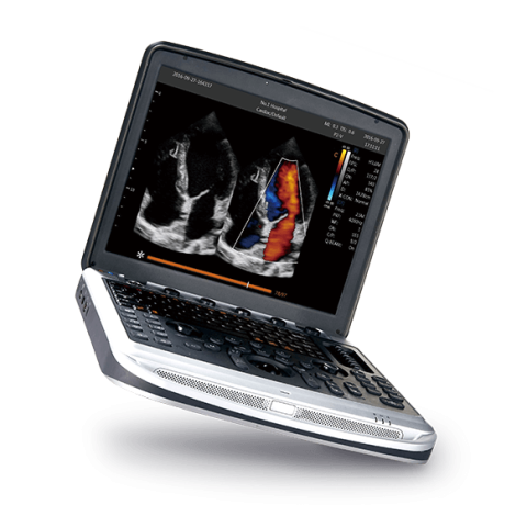 УЗИ аппарат Chison SonoTouch 80 (SonoBook 8) - 0 руб.