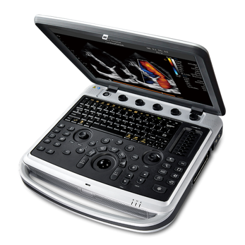 УЗИ аппарат Chison SonoBook 7 - 1 301 300 руб.