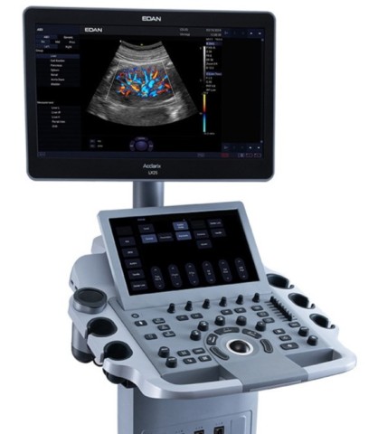 УЗИ аппарат Edan Acclarix LX25 - 945 548 руб.