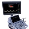 УЗИ аппарат Edan Acclarix LX9 - 2 236 028 руб.