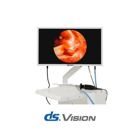 Эндоскопическая видеосистема DS.Vision FHD 3in1 - 0 руб.