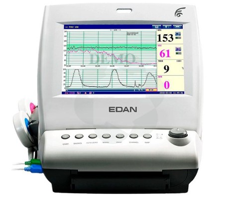 Монитор фетальный Edan F6 Express - 389 343 руб.