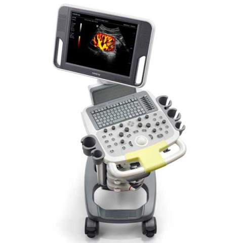 УЗИ сканер Mindray DC-N3 - 318 100 руб.