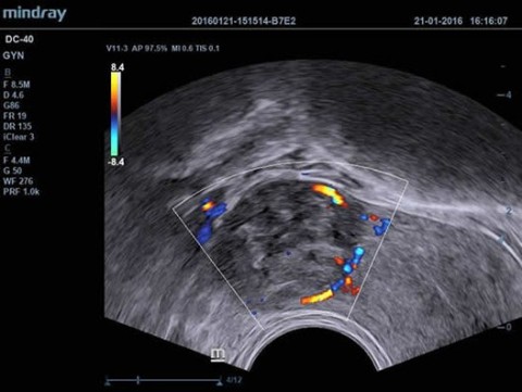 Аппарат ультразвуковой диагностический DC-40 - 389 900 руб.