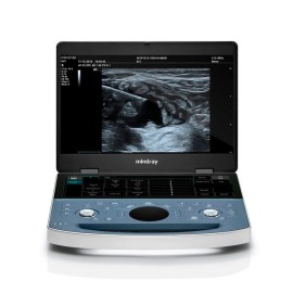 УЗИ аппарат Mindray ME7
