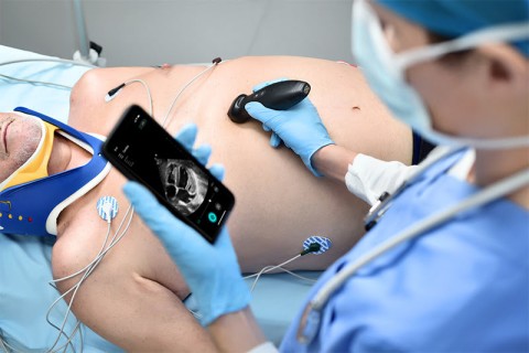 УЗИ сканер Mindray TE Air i3P - 337 000 руб.