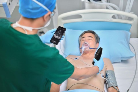 УЗИ сканер Mindray TE Air i3P - 337 000 руб.