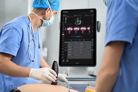 УЗИ сканер Mindray TE Air i3P - 337 000 руб.