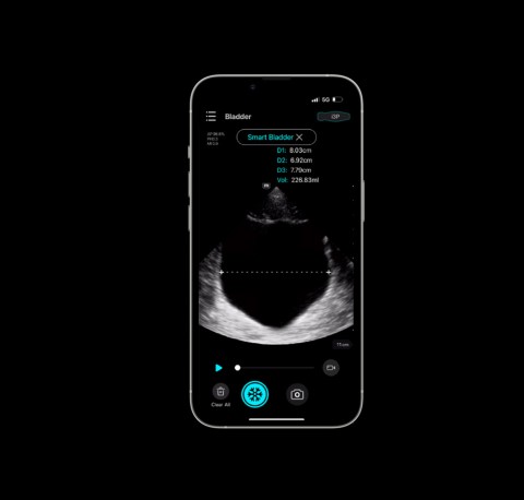 УЗИ сканер Mindray TE Air i3P - 337 000 руб.