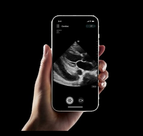 УЗИ сканер Mindray TE Air i3P - 337 000 руб.