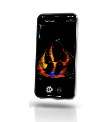 УЗИ сканер Mindray TE Air i3P - 337 000 руб.