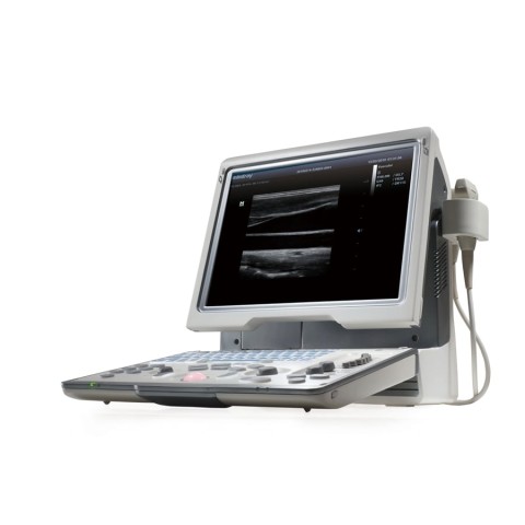 УЗИ аппарат Mindray DP-50 Color - 359 900 руб.